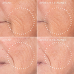 Grain de peau affiné au bout de huit semaines